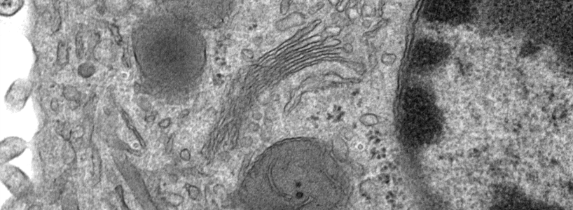 Transmission Electron Microscope image of cell cytoplasm with golgi